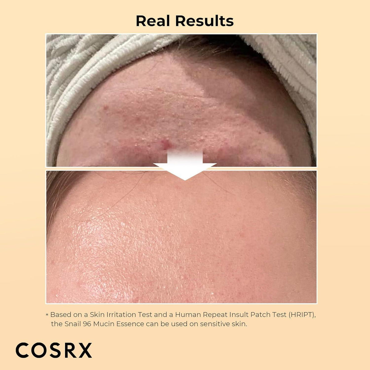 COSRX Advanced Snail 96 Mucin Power Essence 100ml hydrating facial essence
